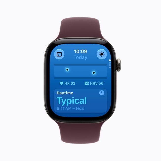 Apple Watch Series 12 viser dagsstatus for puls og pulsvariasjon med vurderingen Typical